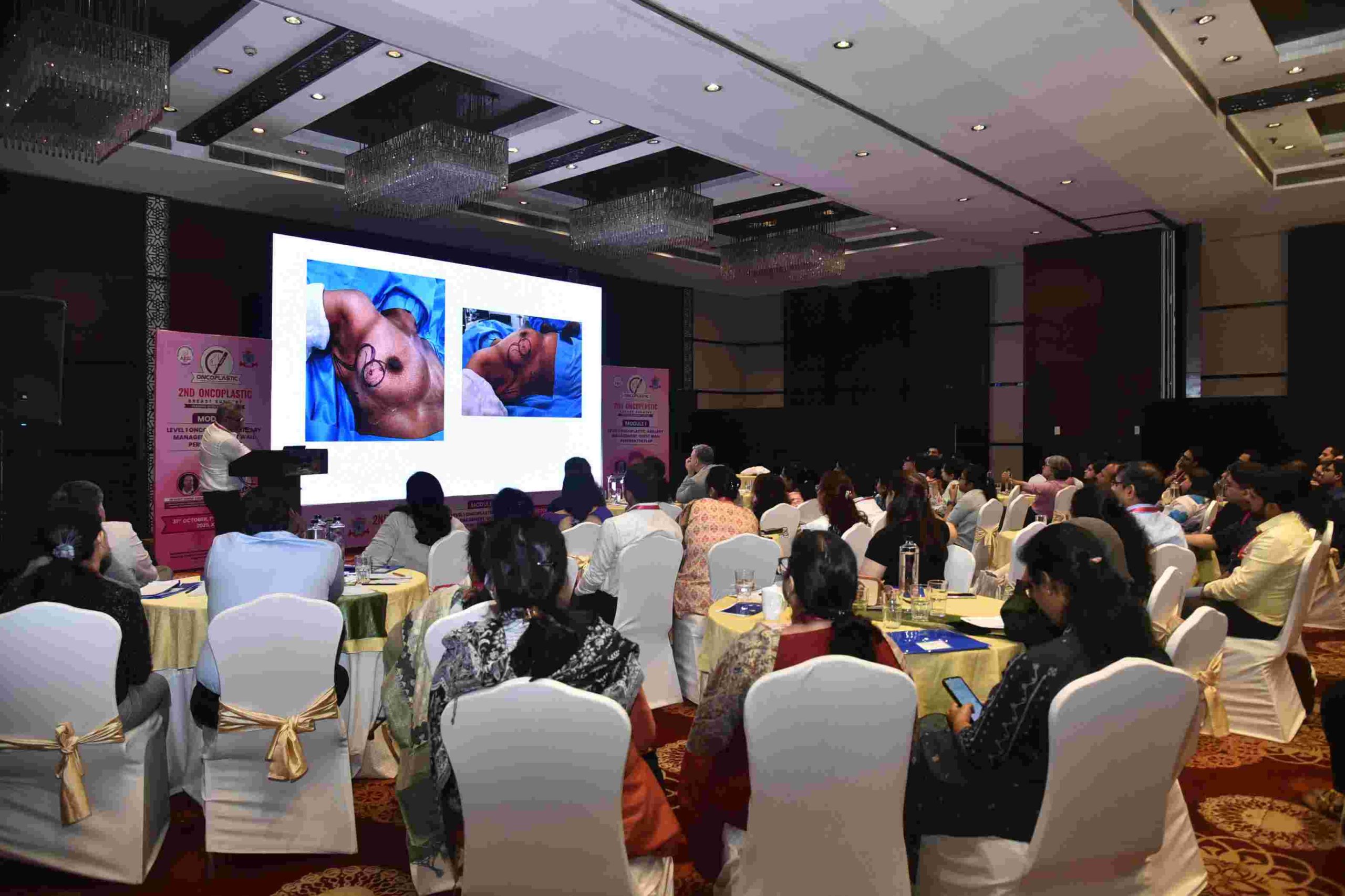 Oncolpastic Breast Surgery